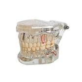 Fuji Typodont Çene Patolojik Model